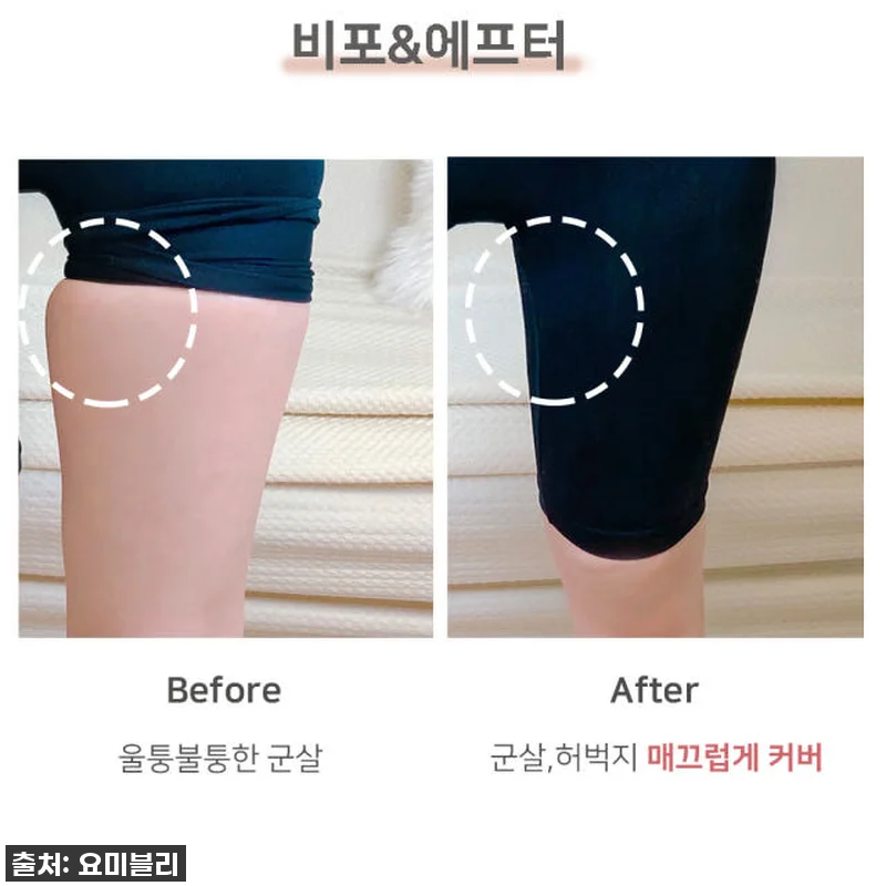 찐후기: 탄력UP, 라인UP! 허벅지 관련 이미지 1
