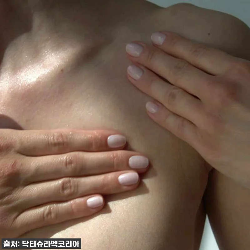 찐후기! 닥터슈라멕 타임 컨트롤 리펌 관련 이미지 4