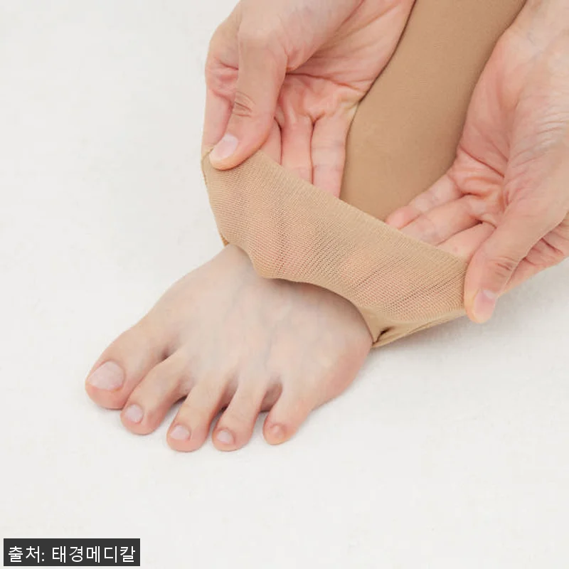 알자토 의료용 압박스타킹 S 사이즈 사용후기 - 종아리 붓기 완화에 탁월한 선택 17 알자토 의료용 압박스타킹 S 사이즈 관련 이미지 6